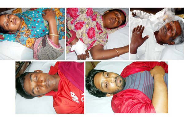 নাটোরে নির্বাচনী সহিংসতায় নারীসহ আহত ৫