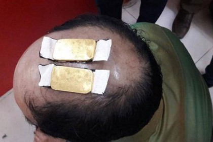 স্বর্ণ পাচারে এবার অভিনব পদ্ধতি ‘টাক মাথা’ (ভিডিও)