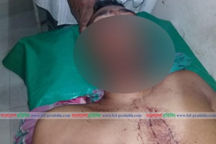 ঘুমের মধ্যে স্বামীকে গলা কেটে হত্যা চেষ্টা স্ত্রীর!