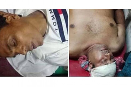 মঠবাড়িয়ায় নৌকার প্রার্থীকে কুপিয়ে জখম 

