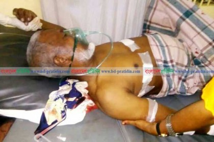 টেকনাফে দুর্বৃত্তদের গুলিতে রোহিঙ্গা নেতা আহত