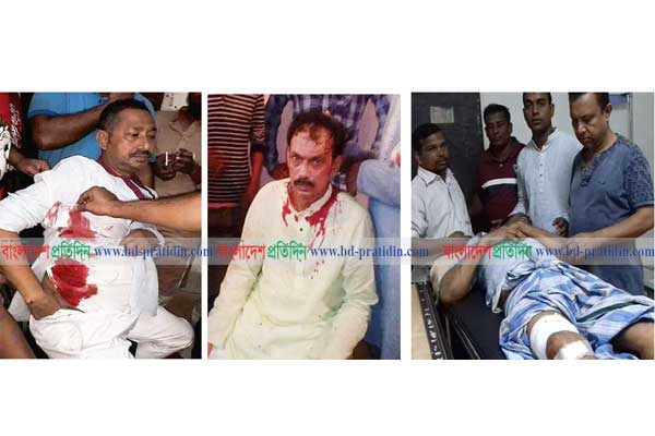 ফরিদপুরে সন্ত্রাসী হামলায় বিএনপি নেতাসহ আহত ১০