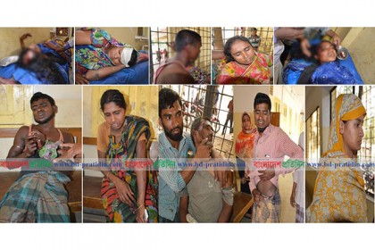 লামায় শ্বশুর-জামাই পক্ষের সংঘর্ষে আহত ১০  