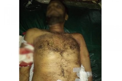 খুলনায় ছুরিকাঘাতে ঠিকাদার নিহত