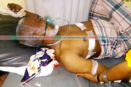  গুলিবিদ্ধ রোহিঙ্গা নেতার মৃত্যু