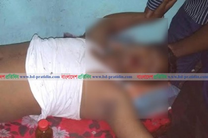 সাতক্ষীরায় এনজিও কর্মীর জিহ্বা কেটে টাকা ছিনতাই!