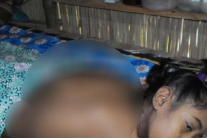 চিকিৎসার অভাবে ৩ বছর ধরে শয্যাশায়ী স্কুলছাত্রী মাসুরা