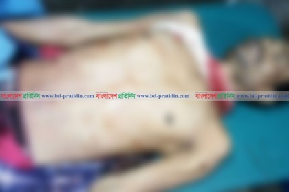 টেকনাফে রোহিঙ্গা ক্যাম্পে দুর্বৃত্তদের গুলিতে ডাকাত নিহত