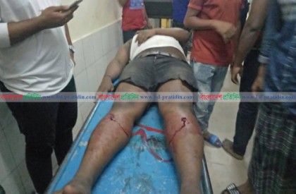 চাঁদা না দেয়ায় ড্রিল দিয়ে পা ফুটো
