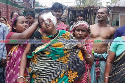 নন্দীগ্রামে গৃহবধূর চোখ তোলার চেষ্টা, স্বামী-শাশুড়ি আটক