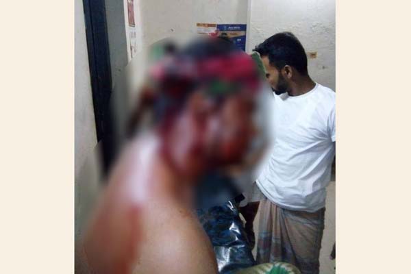 খুলনায় দুর্বৃত্তদের হামলায় সাংবাদিক রক্তাক্ত