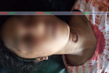 খুলনায় গৃহবধূকে হত্যা, গলায় কামড়ের দাগ