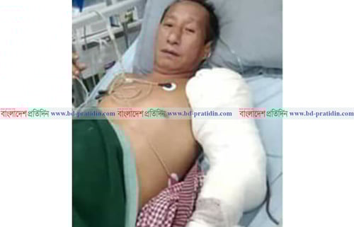 বাঘাইছড়িতে সন্ত্রাসীদের ব্রাশ ফায়ারে আহত আরও একজনের মৃত্যু