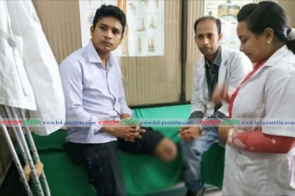 কৃত্রিম পা নিতে সাভারের সিআরপিতে রাসেল
