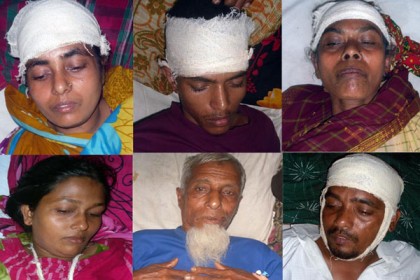 মোরেলগঞ্জে একই পরিবারের ৭ জনকে কুপিয়ে জখম