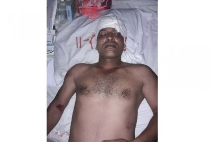 বরিশালে যুবলীগ নেতার পায়ের রগ কর্তন

