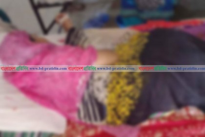 দুই কন্যা সন্তান হওয়ায় গৃহবধূর গায়ে গরম ডাল নিক্ষেপ