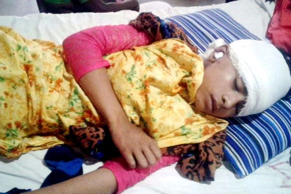 বখাটের কোপ; ওসমানী হাসপাতালে লড়ছে সামিরা

