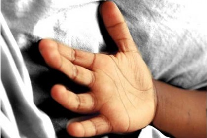 রাজবাড়ীতে গলায় লিচু আটকে শিশুর মৃত্যু