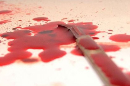 ফরিদপুরে কুপিয়ে হত্যার চেষ্টা

