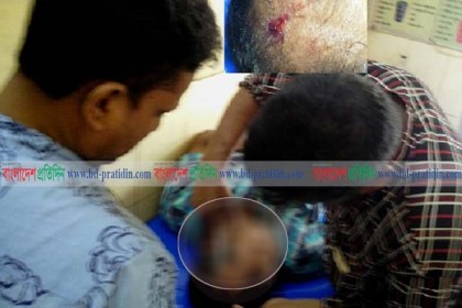 মির্জাপুরে সালিশ বৈঠকে সশস্ত্র হামলা, আওয়ামী লীগের সভাপতি ও সম্পাদক আহত