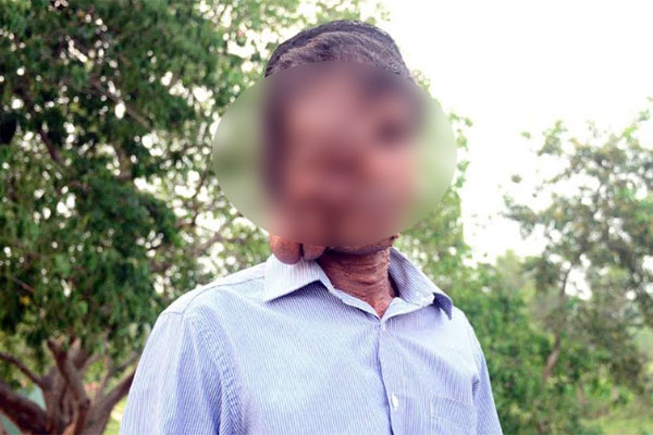 অর্থাভাবে চিকিৎসা বন্ধ বিরল রোগে আক্রান্ত জিলু’র