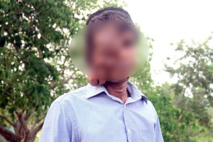 অর্থাভাবে চিকিৎসা বন্ধ বিরল রোগে আক্রান্ত জিলু’র
