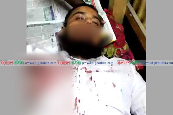 রূপগঞ্জে ভিখারিকে ধমক দেয়ার প্রতিবাদকারীকে কুপিয়েছে মাদক ব্যবসায়ীরা
