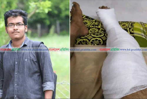 চবি ছাত্রের পা ভেঙে দিল রেলওয়ের নিরাপত্তাকর্মী, প্রতিবাদে মানববন্ধন