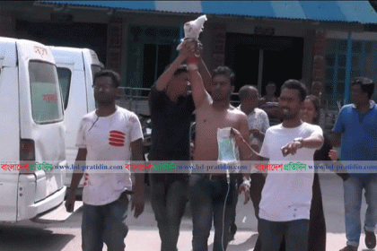 
সাতক্ষীরায় ব্যবসায়ীর হাতের ৪টি আঙুল কেটে নিল ছাত্রলীগ