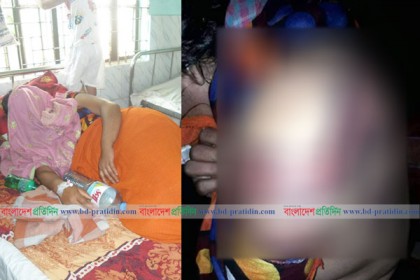 যৌতুক লোভী স্বামী-শ্বশুরের হাতে নির্যাতিত স্কুল শিক্ষিকা