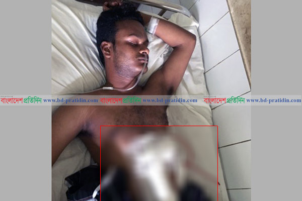 ববি’তে বিরোধের জেরে এক শিক্ষার্থীকে কুপিয়ে জখম