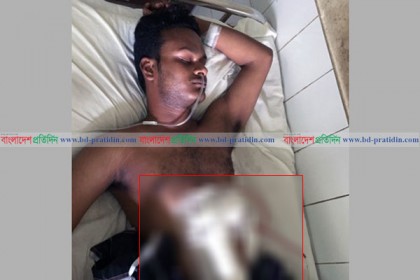 ববি’তে বিরোধের জেরে এক শিক্ষার্থীকে কুপিয়ে জখম