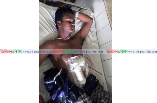 এক শিক্ষার্থীকে কোপানোয় বরিশাল বিশ্ববিদ্যালয়ের অপর শিক্ষার্থী বহিষ্কার