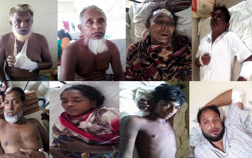 কলাপাড়ায় পৃথক ঘটনায় আহত ১০
