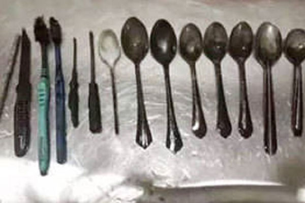 যুবকের পাকস্থলী থেকে ছুরি, স্ক্রু-ড্রাইভার, চামচ ও টুথব্রাশ উদ্ধার!