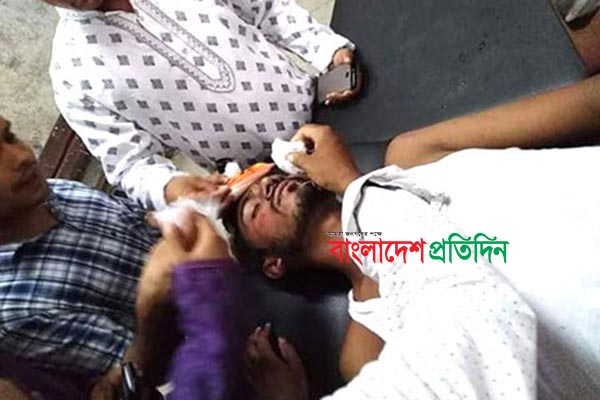 বগুড়ায় ইফতার মাহফিলে ভিপি নূরকে পিটিয়ে আহত
