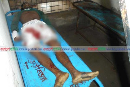 মাগুরায় সড়ক দুর্ঘটনায় নিহত ২, আহত ২