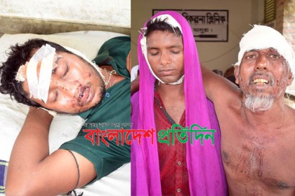 মহম্মদপুরে আওয়ামী লীগের দু’পক্ষের সংঘর্ষে আহত ২০