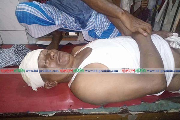 
বরিশালে সাবেক ইউপি সদস্যকে কুপিয়ে হত্যা