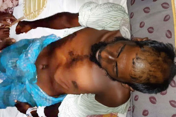 বাকেরগঞ্জে ব্যবসায়ীর মাথার চুল কেটে গরম আলকাতরা ঢেলে দেওয়ার অভিযোগ 

