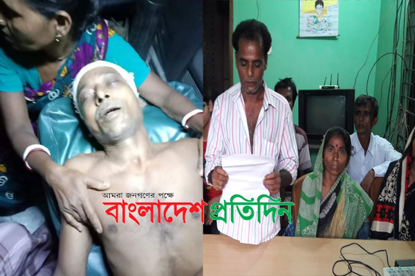 শরীয়তপুরে কাঠমিস্ত্রীকে পিটিয়ে জখম