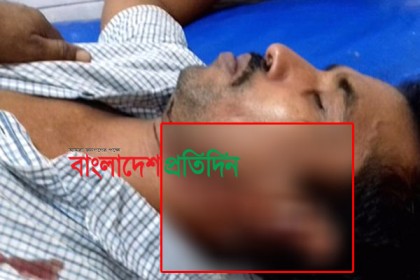 সাতক্ষীরায় কলেজ ছাত্রীর বাবার কান ছিঁড়ে নিল বখাটে