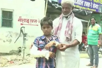 বাঁ-হাত ভাঙা রোগীর প্লাস্টার হলো ডান হাতে!