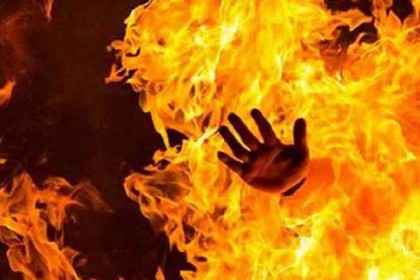 সুস্থ না হওয়ায় সন্তানকে পুড়িয়ে হত্যা!