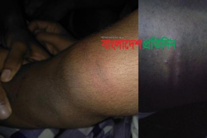 ঢাবির হলে এজিএসের তত্ত্বাবধানে 'গেস্টরুম', ২৪ শিক্ষার্থীকে মারধর