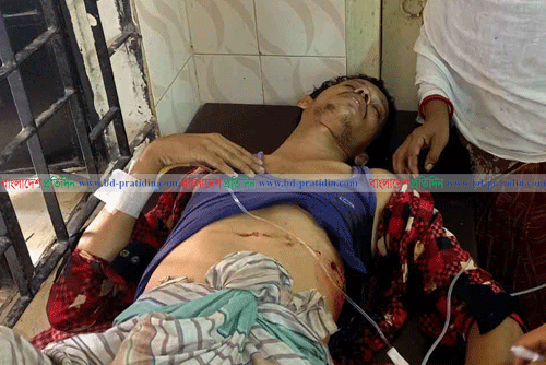 খাগড়াছড়িতে সন্ত্রাসীদের গুলিতে ফল ব্যবসায়ী আহত 