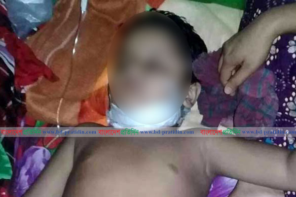 বাগমারায় শিশুকে গলা কেটে হত্যার চেষ্টা!
