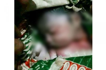 সিজারে টানা হেঁচড়ায় নবজাতকের গলা কেটে মৃত্যু