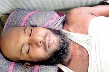 কামড় খাওয়ার পরে সেই সাপ হাতে ধরে বাড়িতে ফোন, অতঃপর...!